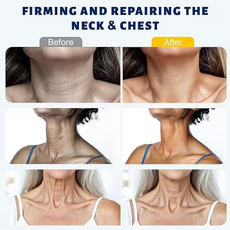 Crema de masaje para cuello con rodillo 🧴 Colágeno y ácido hialurónico | Reafirma el cuello, reduce las arrugas y la papada✨