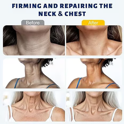 Crema de masaje para cuello con rodillo 🧴 Colágeno y ácido hialurónico | Reafirma el cuello, reduce las arrugas y la papada✨