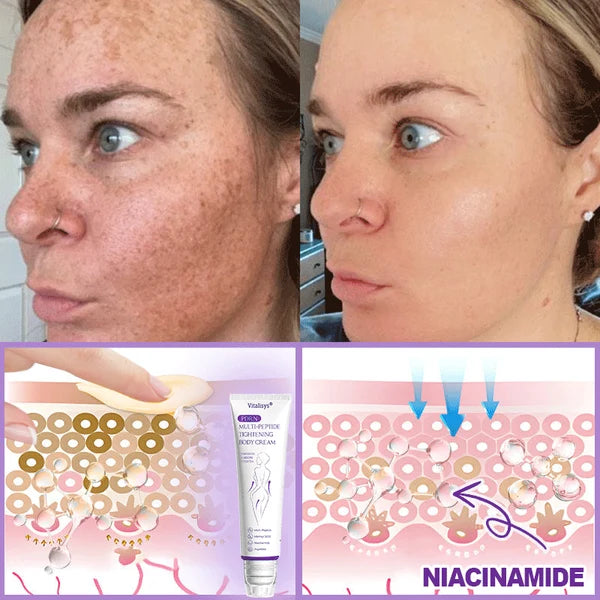 𝐃𝐞𝐫𝐦𝐚𝐭𝐨𝐥𝐨𝐠𝐢𝐬𝐭-𝐑𝐞𝐜𝐨𝐦𝐦𝐞𝐧𝐝𝐞𝐝 👩|Alcuras® 𝐏𝐃𝐑𝐍 𝐌𝐮𝐥𝐭𝐢-𝐏𝐞𝐩𝐭𝐢𝐝𝐞 𝐌𝐚𝐬𝐬𝐚𝐠𝐢𝐧𝐠 𝐁𝐨𝐝𝐲 𝐑𝐨𝐥𝐥𝐞𝐫 𝐂𝐫𝐞𝐚𝐦, 𝐀𝐧𝐭𝐢-𝐚𝐠𝐢𝐧𝐠, 𝐇𝐲𝐝𝐫𝐚𝐭𝐢𝐧𝐠, 𝐒𝐤𝐢𝐧 𝐅𝐢𝐫𝐦𝐢𝐧𝐠 & 𝐋𝐢𝐟𝐭𝐢𝐧𝐠, 𝐒𝐤𝐢𝐧 𝐑𝐞𝐩𝐚𝐢𝐫, 𝐄𝐯𝐞𝐧 𝐓𝐨𝐧𝐞, 𝐀𝐜𝐧𝐞 𝐚𝐧𝐝 𝐃𝐚𝐫𝐤 𝐒𝐩𝐨𝐭 𝐓𝐫𝐞𝐚𝐭𝐦𝐞𝐧𝐭, 𝐖𝐚𝐫𝐭 𝐚𝐧𝐝 𝐌𝐨𝐥𝐞 𝐑𝐞𝐦𝐨𝐯𝐚𝐥, 𝐚𝐧𝐝 𝐏𝐬𝐨𝐫𝐢𝐚𝐬𝐢𝐬 𝐑𝐞𝐥𝐢𝐞𝐟.